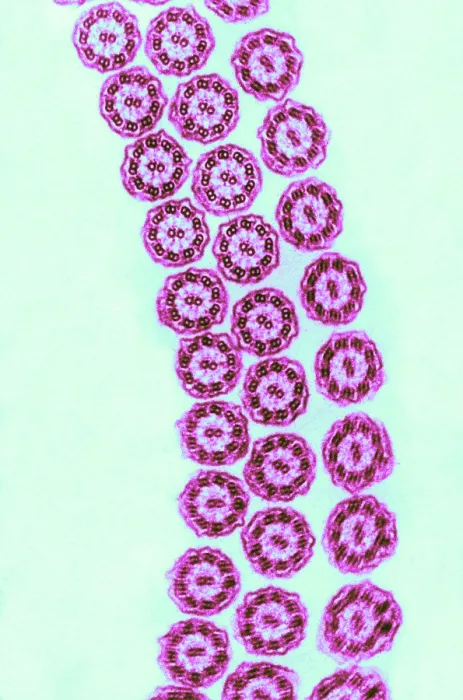 Framed Print : Cilia from Ciliates (TEM)