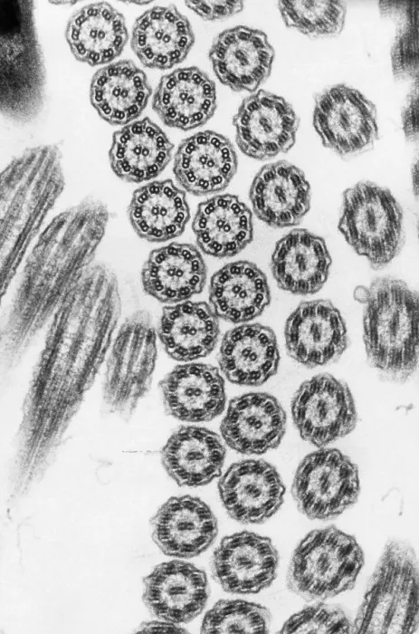 Framed Print : Cilia from Ciliates (TEM) Framed Print : Cilia from Ciliates (TEM)