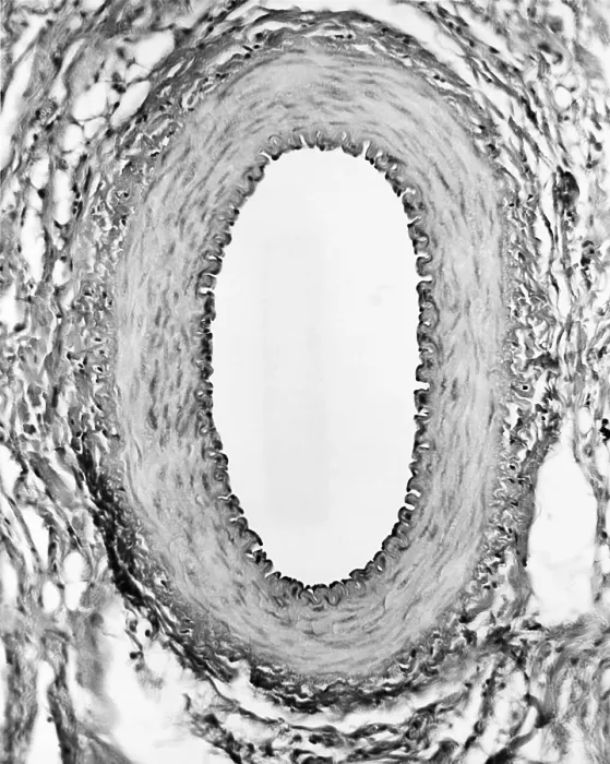 Framed Print : Circulatory System, Healthy Artery, TEM Framed Print : Circulatory System, Healthy Artery, TEM