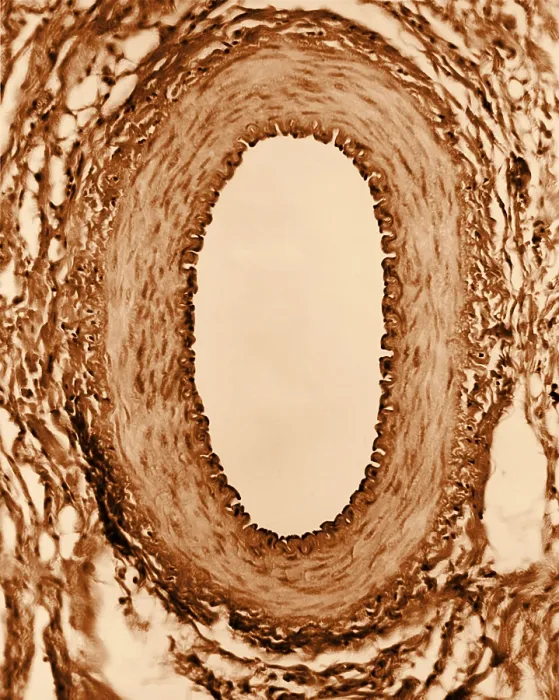 Framed Print : Circulatory System, Healthy Artery, TEM