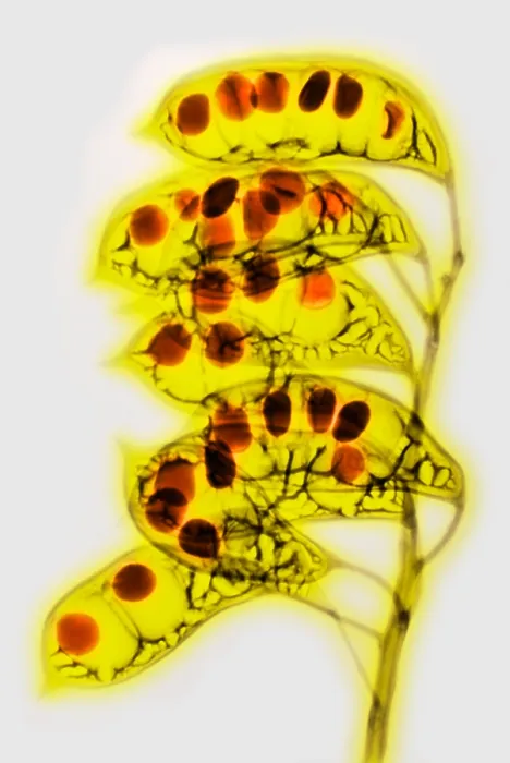 Framed Print : Colorized X-ray of Seed Pods