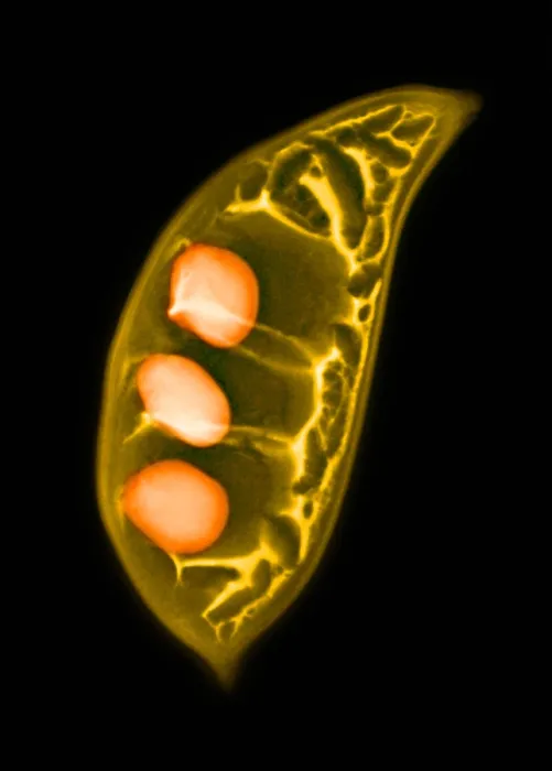 Framed Print : Colorized X-ray of Seed Pods Framed Print : Colorized X-ray of Seed Pods