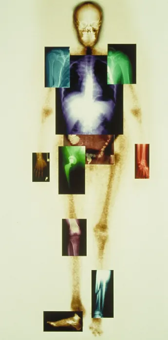 Framed Print : Composite of body Framed Print : Composite of body