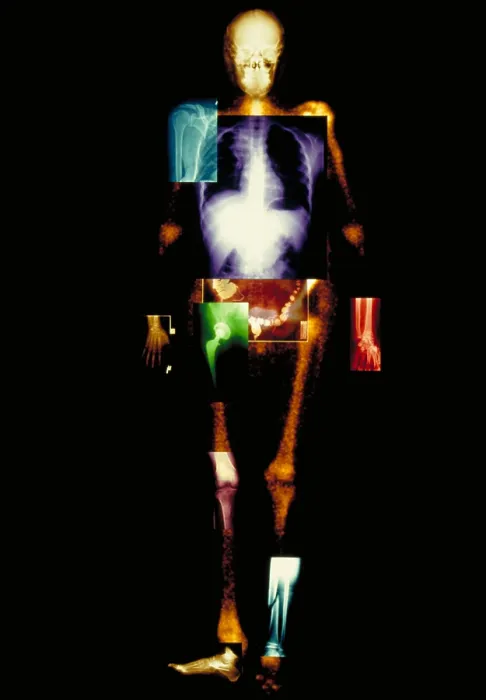 Framed Print : Composite of body