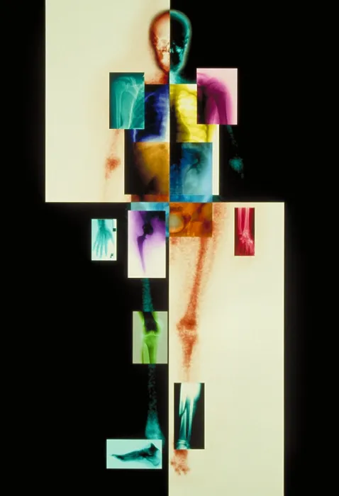 Framed Print : Composite of body