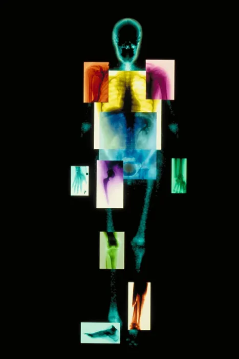 Framed Print : Composite of body Framed Print : Composite of body