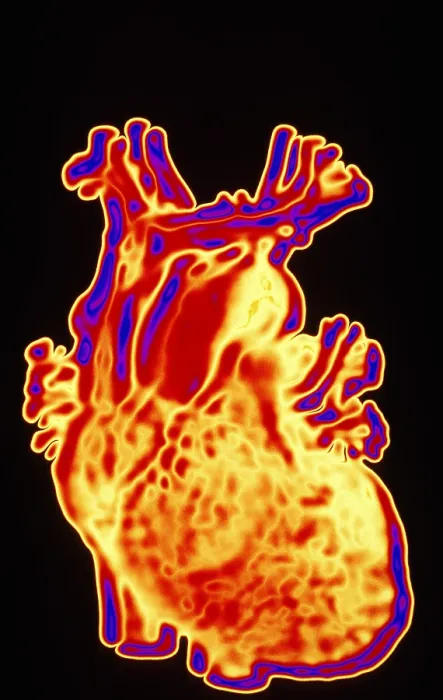 Framed Print : Computer enhanced heart