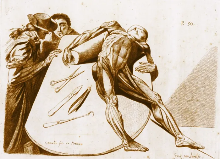 Framed Print : Contemplating a Cadaver