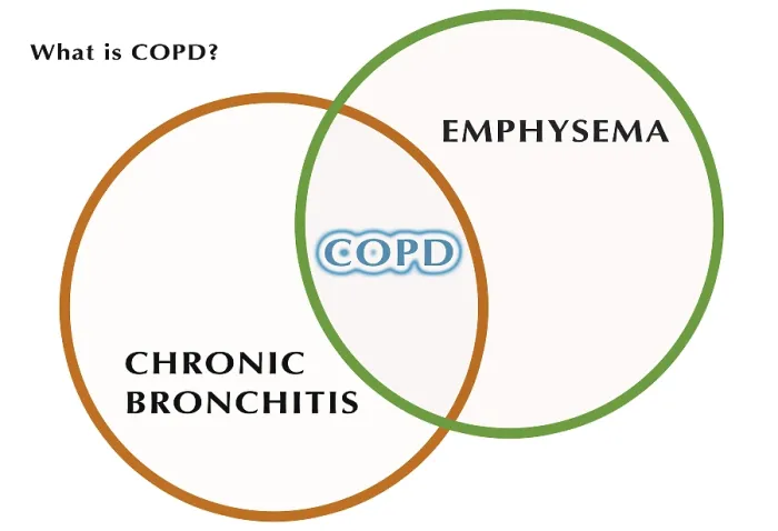 Framed Print : What is COPD? Framed Print : What is COPD?
