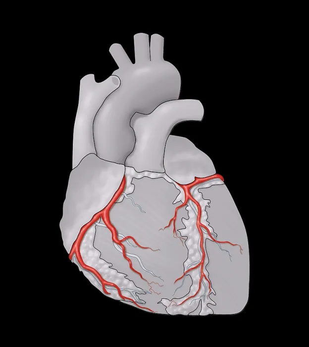 Framed Print : Coronary Arteries, Illustration Framed Print : Coronary Arteries, Illustration