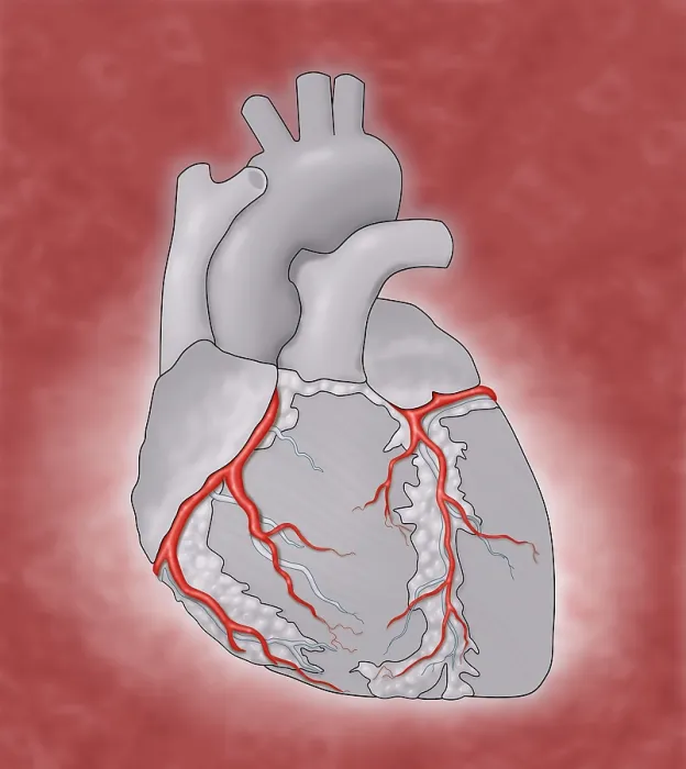 Framed Print : Coronary Arteries, Illustration Framed Print : Coronary Arteries, Illustration