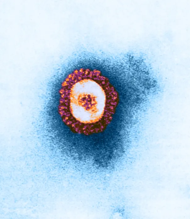 Framed Print : Coronavirus, TEM