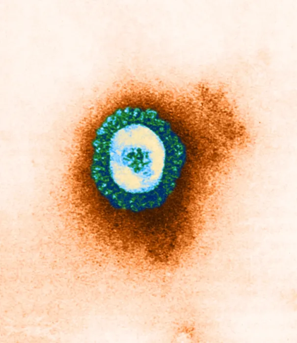 Framed Print : Coronavirus, TEM Framed Print : Coronavirus, TEM