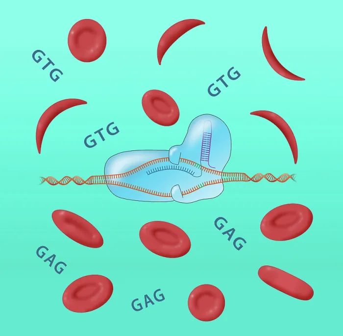 Framed Print : CRISPR cure for Sickle cell anemia disease and Normal Blood Cells, gtg, gag, Conceptual Illustration