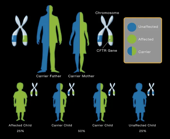Framed Print : Cystic fibrosis disease CFTR genetic mutation Inheritance pattern diagram of parents and children Framed Print : Cystic fibrosis disease CFTR genetic mutation Inheritance pattern diagram of parents and children