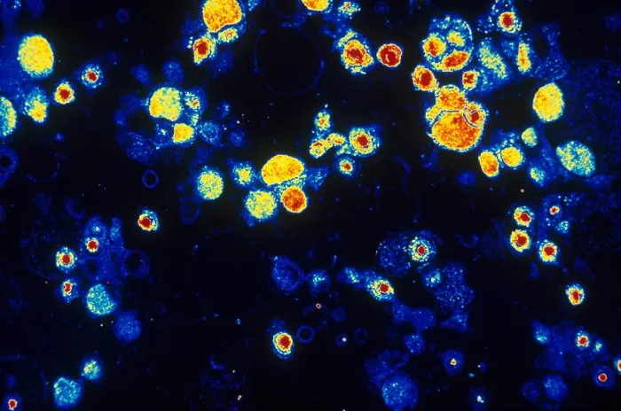 Framed Print : Cytomegalovirus (TEM)