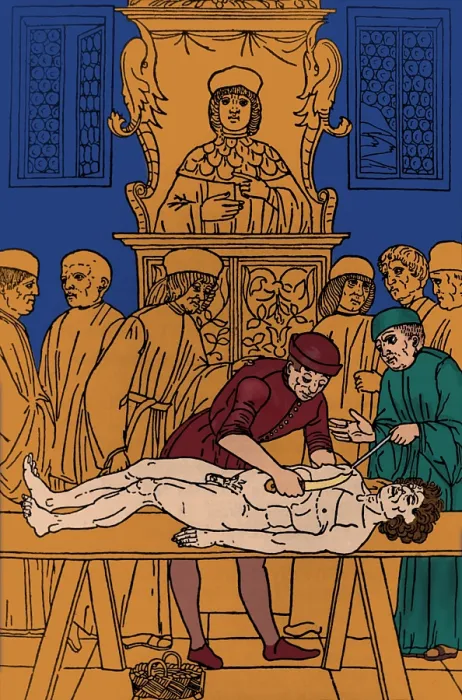 Framed Print : Dissection of Cadaver, 1491 Framed Print : Dissection of Cadaver, 1491