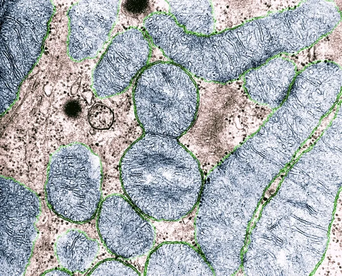 Framed Print : Dividing Mitochondrion, TEM Framed Print : Dividing Mitochondrion, TEM