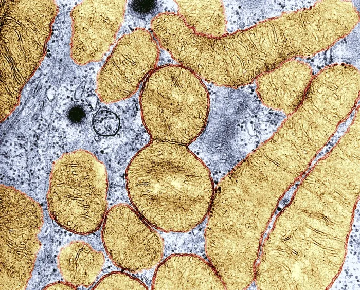 Framed Print : Dividing Mitochondrion, TEM Framed Print : Dividing Mitochondrion, TEM