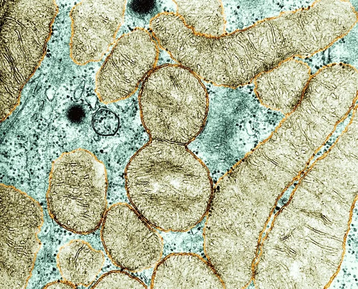 Framed Print : Dividing Mitochondrion, TEM Framed Print : Dividing Mitochondrion, TEM