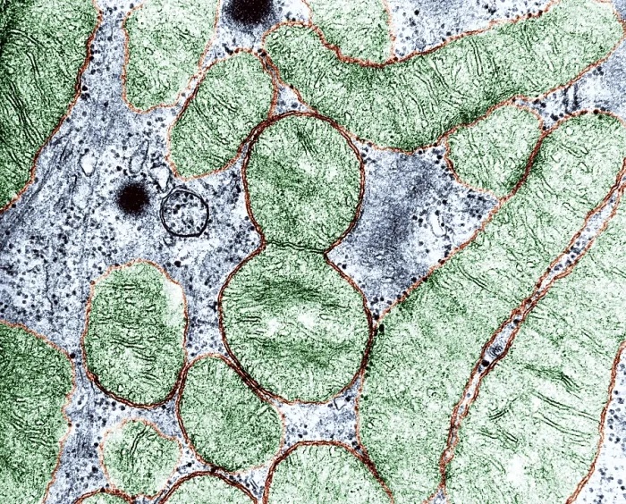 Framed Print : Dividing Mitochondrion, TEM Framed Print : Dividing Mitochondrion, TEM