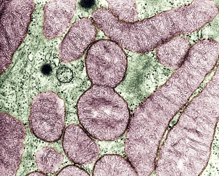 Framed Print : Dividing Mitochondrion, TEM