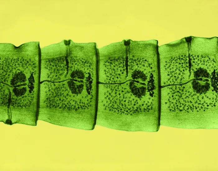 Framed Print : Dog Tapeworm under a microscope