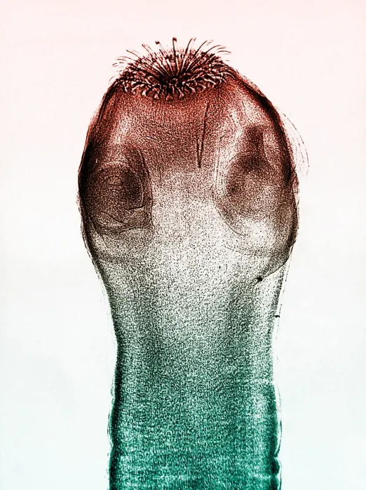 Framed Print : Dog Tapeworm Scolex, light micrograph Framed Print : Dog Tapeworm Scolex, light micrograph