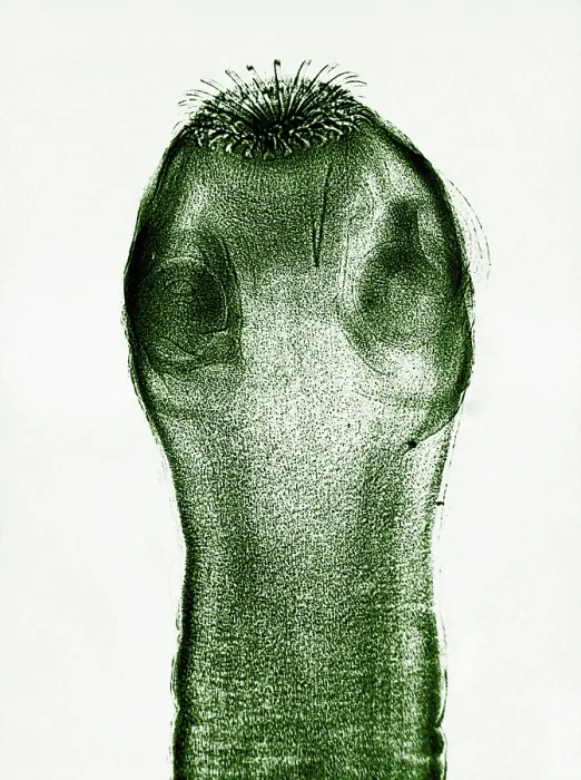 Framed Print : Dog Tapeworm Scolex, light micrograph Framed Print : Dog Tapeworm Scolex, light micrograph