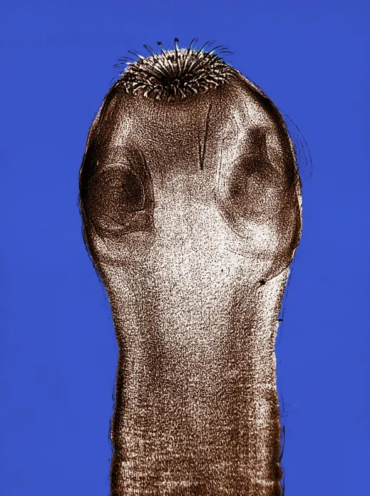 Framed Print : Dog Tapeworm Scolex, light micrograph