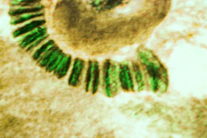 Framed Print : Drosophila chromosome, light micrograph Framed Print : Drosophila chromosome, light micrograph