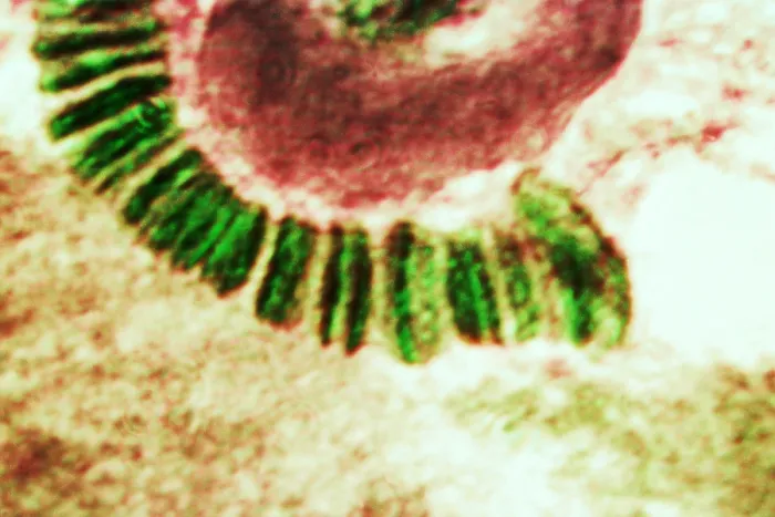 Framed Print : Drosophila chromosome, light micrograph Framed Print : Drosophila chromosome, light micrograph