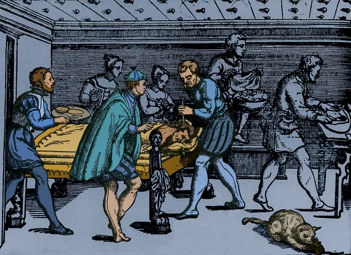Framed Print : Earliest Depiction of Craniotomy, 1573