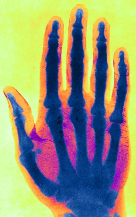 Framed Print : Early X-ray Framed Print : Early X-ray
