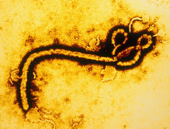 Framed Print : Ebola Zaire Virus (TEM) Framed Print : Ebola Zaire Virus (TEM)