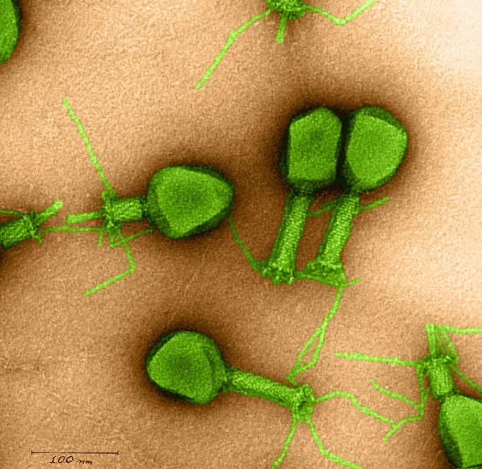 Framed Print : Enterobacteria Phage T4, TEM Framed Print : Enterobacteria Phage T4, TEM