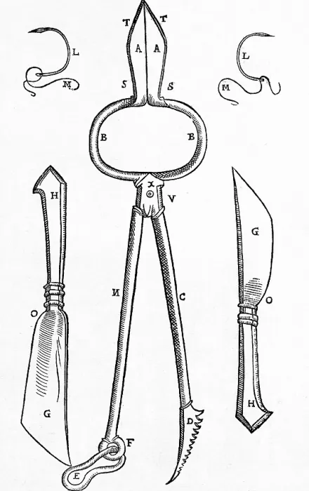 Framed Print : Equipment for One of Tagliacozzi's Rhinoplasty Methods Framed Print : Equipment for One of Tagliacozzi's Rhinoplasty Methods