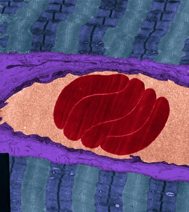 Framed Print : Erythrocytes, Capillary, Muscle Fibers, TEM