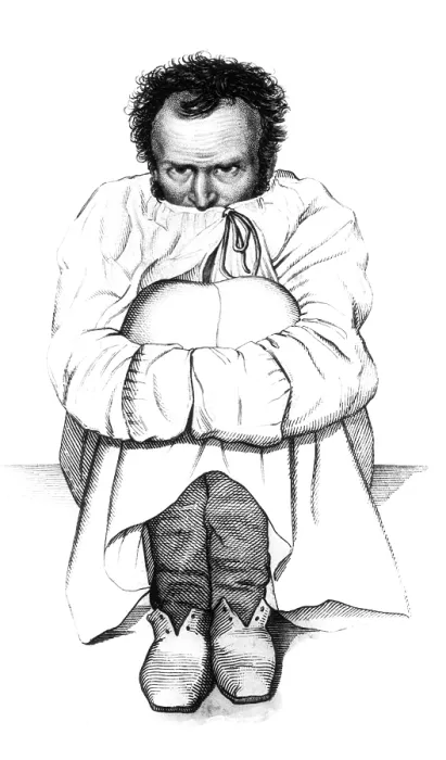 Framed Print : Esquirol Patient, Dementia, 1838 Framed Print : Esquirol Patient, Dementia, 1838