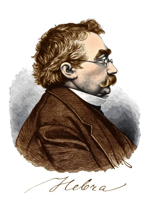 Framed Print : Ferdinand von Hebra, German Dermatologist Framed Print : Ferdinand von Hebra, German Dermatologist