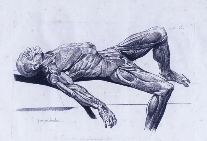 Framed Print : A flayed cadaver Framed Print : A flayed cadaver