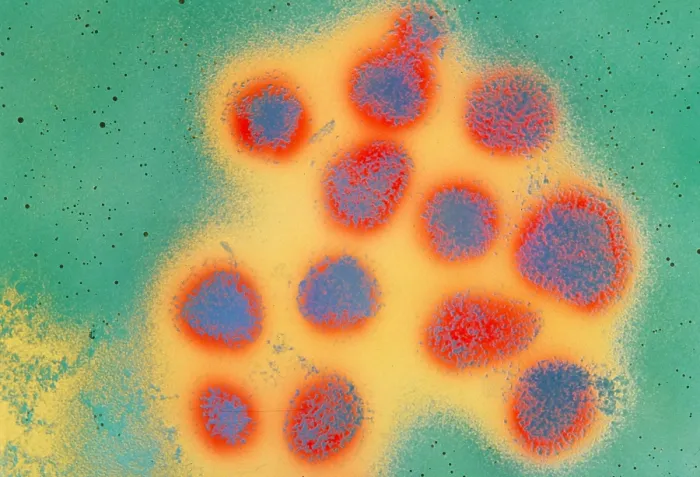 Framed Print : Flu virus. Magnification x225, 000 Framed Print : Flu virus. Magnification x225, 000