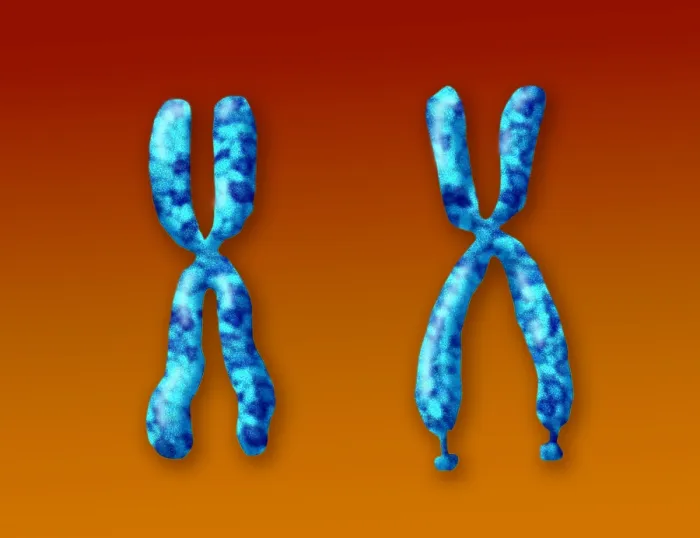 Framed Print : Fragile X Syndrome (FXS) is a genetic condition often associated with autism spectrum disorder (ASD), illustration
