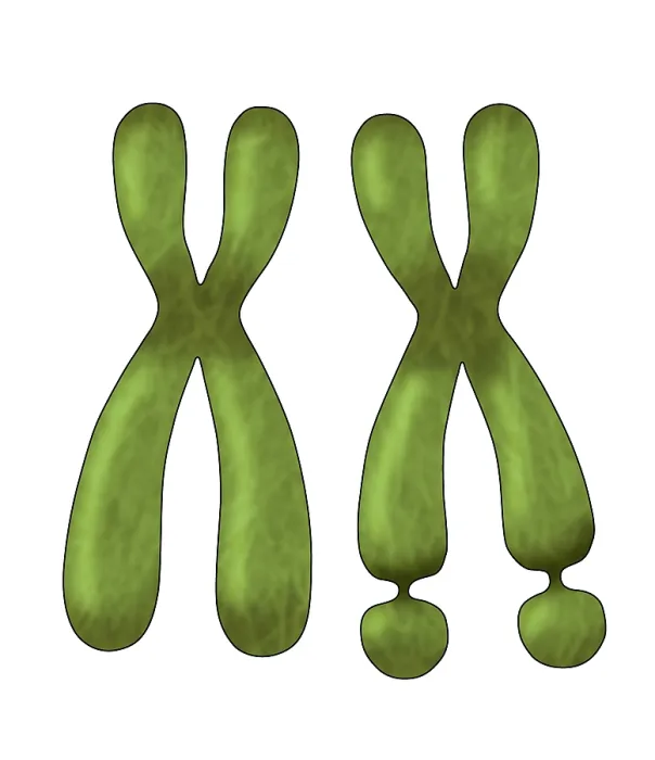 Framed Print : Fragile X Syndrome (FXS) is a genetic condition often associated with autism spectrum disorder (ASD), illustration Framed Print : Fragile X Syndrome (FXS) is a genetic condition often associated with autism spectrum disorder (ASD), illustration