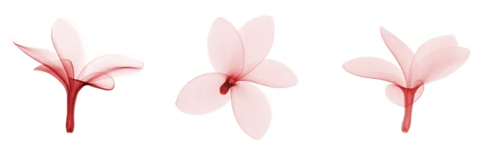 Framed Print : Fragipani (Plumeria) Flowers, X-ray