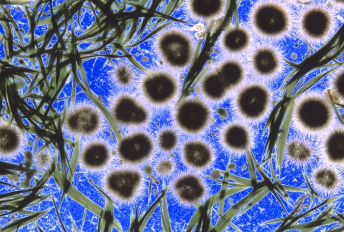 Framed Print : Freshwater Cyanobacteria under a microscope Framed Print : Freshwater Cyanobacteria under a microscope