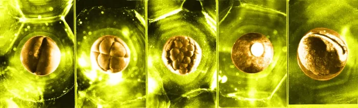 Framed Print : Frog Eggs. Color enhanced image of frog eggs (Ovum) at different stages of growth Framed Print : Frog Eggs. Color enhanced image of frog eggs (Ovum) at different stages of growth