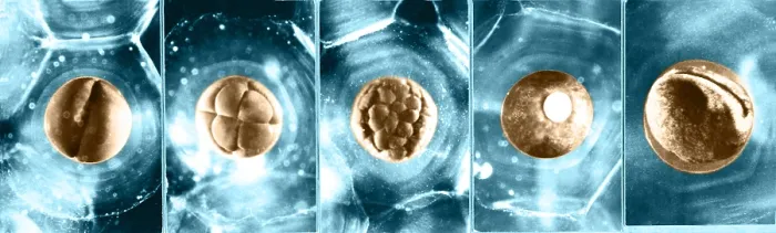 Framed Print : Frog Eggs. Color enhanced image of frog eggs (Ovum) at different stages of growth Framed Print : Frog Eggs. Color enhanced image of frog eggs (Ovum) at different stages of growth