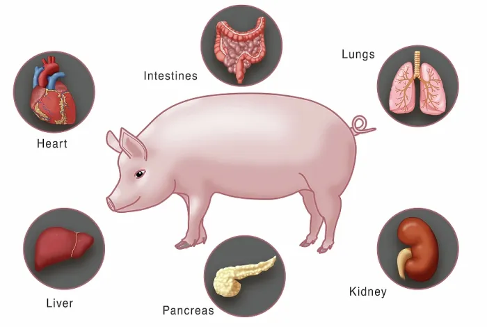 Framed Print : Genetically modified pig and human organs for Xenotransplantation, intestines, lungs, kidney, pancreas, liver and heart, medical illustration Framed Print : Genetically modified pig and human organs for Xenotransplantation, intestines, lungs, kidney, pancreas, liver and heart, medical illustration