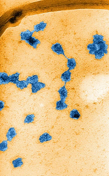 Framed Print : Genetics, Messenger RNA (mRNA), TEM Framed Print : Genetics, Messenger RNA (mRNA), TEM